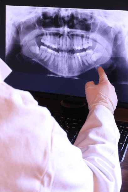 Best Emergency Tooth Extraction in Verdi, NV